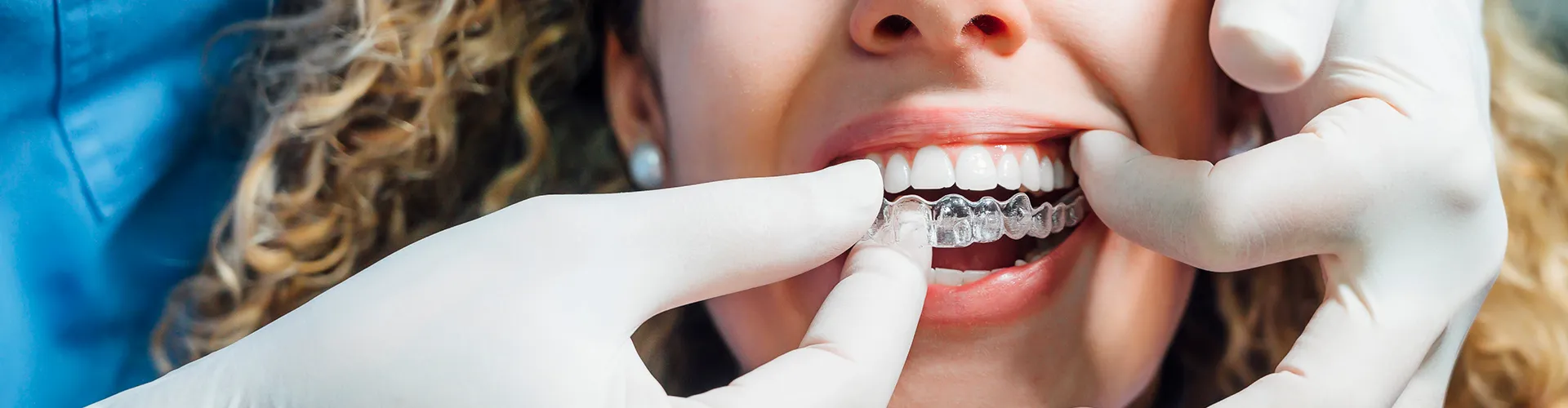 gloved hands placing clear aligner in woman's mouth